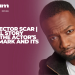 Jamie Hector Scar